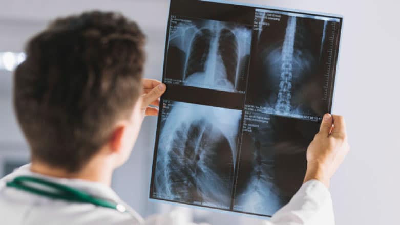 Pune intrebarea potrivita!| Campanie impotriva stigmatizarii pacientilor cu cancer pulmonar